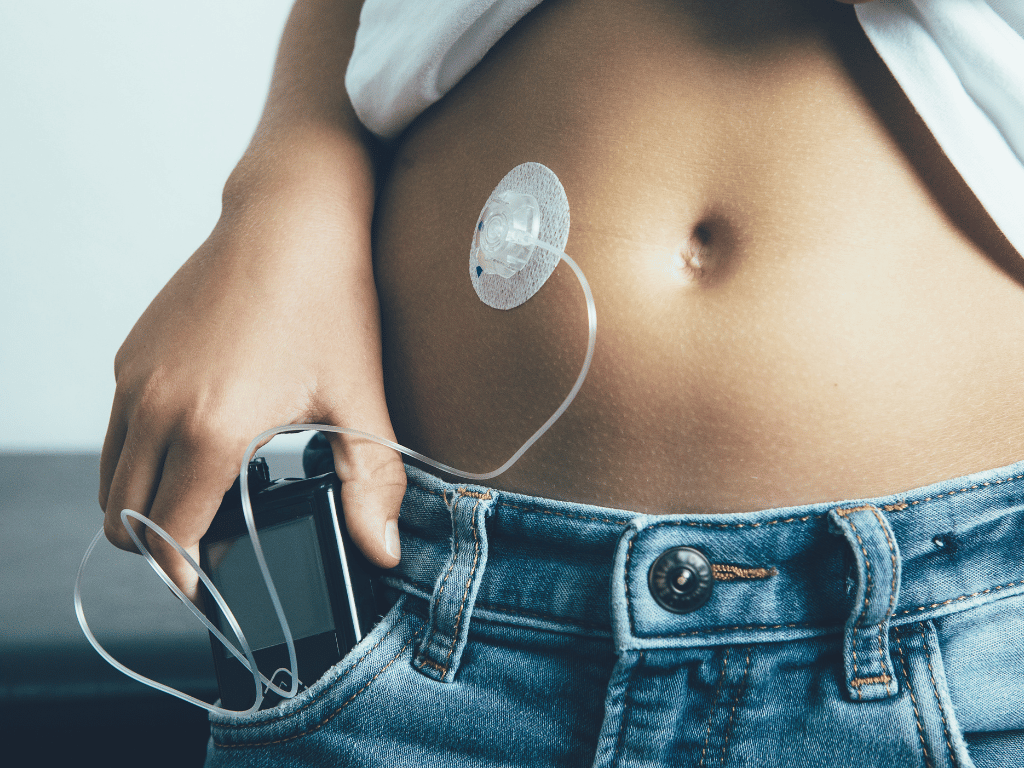 A person holding their insulin pump as they put it back in the jeans pocket. The pump is black with a digital screen and a cannula from the pump is inserted into their skin next to their belly button.